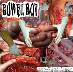 Urinary Tract Infection From Severe Pus Clots : Between the Innards - Pulmonary Sequestion of Uterinalist Arteries (Session A)
